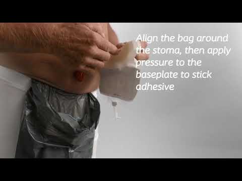 Sensura® Mio Convex 1-Piece Uro Maxi - Transparent - 10/Box