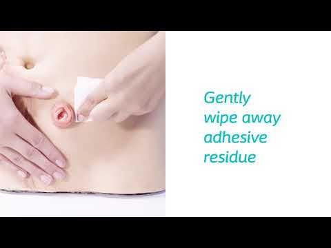 Brava® Adhesive Remover Wipes - 30 /box